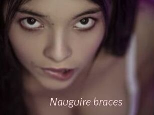 Nauguire_braces
