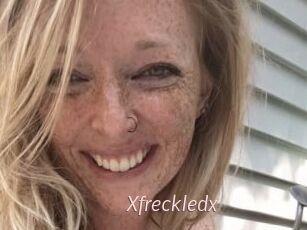 Xfreckledx